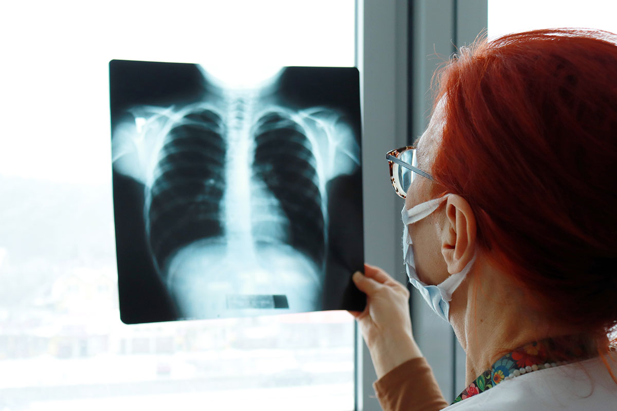 a-doctor-analyzes-lungs